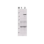 Anti-ROCK-2 (Rho-associated Protein Kinase-2) pY256 (RABBIT) Antibody, 100µg, Liquid (sterile filtered)