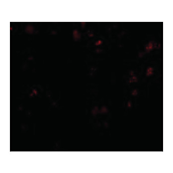 EVER1 Antibody internal 100µg