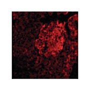 IL-23 Antibody nterm 100µg
