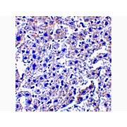 Anti-Caspase-14 (RABBIT) Antibody, 100µg, Liquid (sterile filtered)