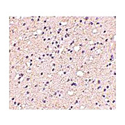 Anti-ELOVL6 (Rabbit) Antibody, 100µg, Liquid (sterile filtered)