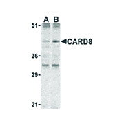 Anti-CARD8 (RABBIT) Antibody, 100µg, Liquid (sterile filtered)