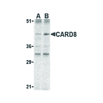 Anti-CARD8 (RABBIT) Antibody, 100µg, Liquid (sterile filtered)