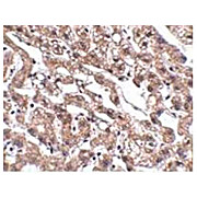 Anti-MACC1 (Rabbit) Antibody, 100µg, Liquid (sterile filtered)