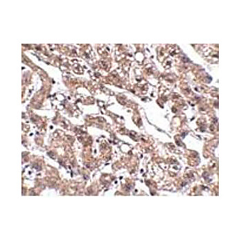 Anti-MACC1 (Rabbit) Antibody, 100µg, Liquid (sterile filtered)