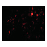 Anti-CAPN6 (RABBIT) Antibody, 100µg, Liquid (sterile filtered)