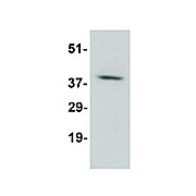DARC Antibody cterm 100µg