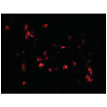 Anti-Cathelicidin (RABBIT) Antibody, 100µg, Liquid (sterile filtered)