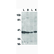 ICAD Antibody 100µg