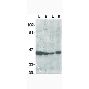 ICAD Antibody 100µg