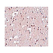 Anti-FRMPD3 (RABBIT) Antibody, 100µg, Liquid (sterile filtered)