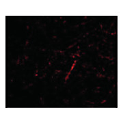 GRIK4 Antibody nterm 100µg