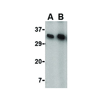 Anti-KAI1 (RABBIT) Antibody, 100µg, Liquid (sterile filtered)