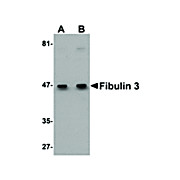 Anti-Fibulin 3 (RABBIT) Antibody, 100µg, Liquid (sterile filtered)
