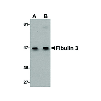 Anti-Fibulin 3 (RABBIT) Antibody, 100µg, Liquid (sterile filtered)