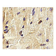 Anti-ECSIT (RABBIT) Antibody, 100µg, Liquid (sterile filtered)