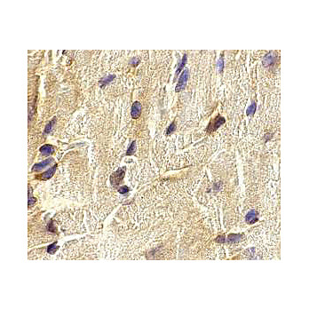 Anti-ECSIT (RABBIT) Antibody, 100µg, Liquid (sterile filtered)