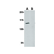 GPVI Antibody cterm 100µg