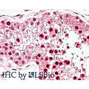 Anti-PIN1 [RABBIT] Antibody, 100µg, Liquid (sterile filtered)