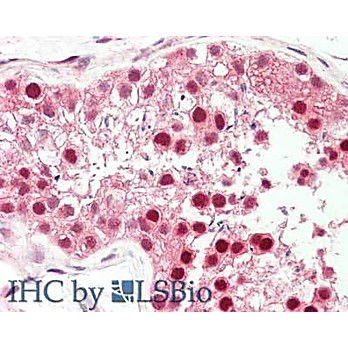 Anti-PIN1 [RABBIT] Antibody, 100µg, Liquid (sterile filtered)