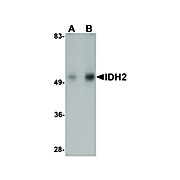 Anti-IDH2 (RABBIT) Antibody, 100µg, Liquid (sterile filtered)