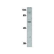 Anti-Dact3 (RABBIT) Antibody, 100µg, Liquid (sterile filtered)