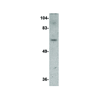Anti-Dact3 (RABBIT) Antibody, 100µg, Liquid (sterile filtered)