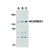 Anti-CARMA1 (RABBIT) Antibody, 100µg, Liquid (sterile filtered)