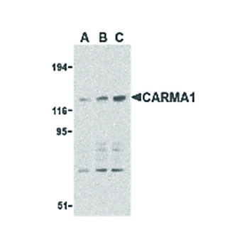 Anti-CARMA1 (RABBIT) Antibody, 100µg, Liquid (sterile filtered)