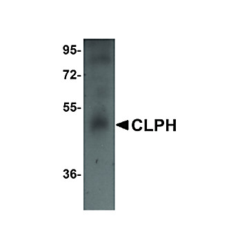 Anti-CLPH (RABBIT) Antibody, 100µg, Liquid (sterile filtered)
