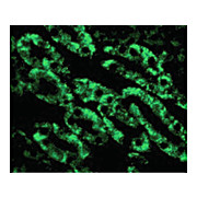 CAD internal Antibody 100µg