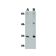 Anti-CUEDC2 (RABBIT) Antibody, 100µg, Liquid (sterile filtered)