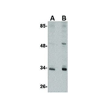 Anti-CUEDC2 (RABBIT) Antibody, 100µg, Liquid (sterile filtered)