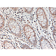 Anti-STAT3 pY705 (RABBIT) Antibody, 25µL, Liquid (sterile filtered)
