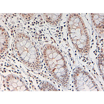 Anti-STAT3 pY705 (RABBIT) Antibody, 25µL, Liquid (sterile filtered)