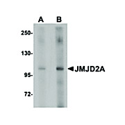 Anti-JMJD2A (RABBIT) Antibody, 100µg, Liquid (sterile filtered)
