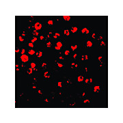 IRAK2 Antibody 100µg
