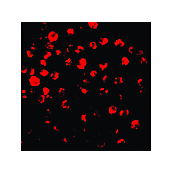 IRAK2 Antibody 100µg