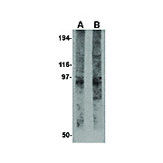 EVER2 Antibody nterm 100µg