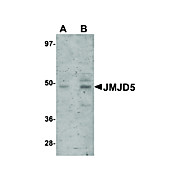 Anti-JMJD5 (RABBIT) Antibody, 100µg, Liquid (sterile filtered)