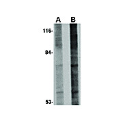 GLE1 Antibody internal 100µg