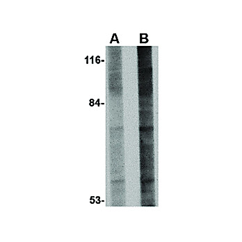 GLE1 Antibody internal 100µg