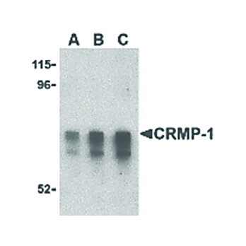 CRMP1 Antibody internal 100µg