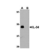 Anti-IL-34 (Rabbit) Antibody, 100µg, Liquid (sterile filtered)
