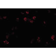 Anti-CD81 (RABBIT) Antibody, 100µg, Liquid (sterile filtered)