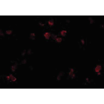 Anti-CD81 (RABBIT) Antibody, 100µg, Liquid (sterile filtered)