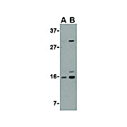 Anti-DRAM (RABBIT) Antibody, 100µg, Liquid (sterile filtered)