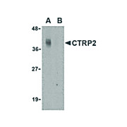 CTRP2 Antibody nterm 100µg