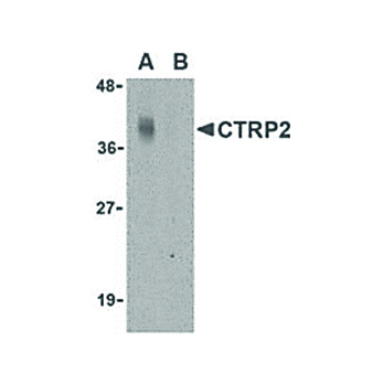 CTRP2 Antibody nterm 100µg