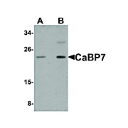 Anti-CaBP7 (RABBIT) Antibody, 100µg, Liquid (sterile filtered)